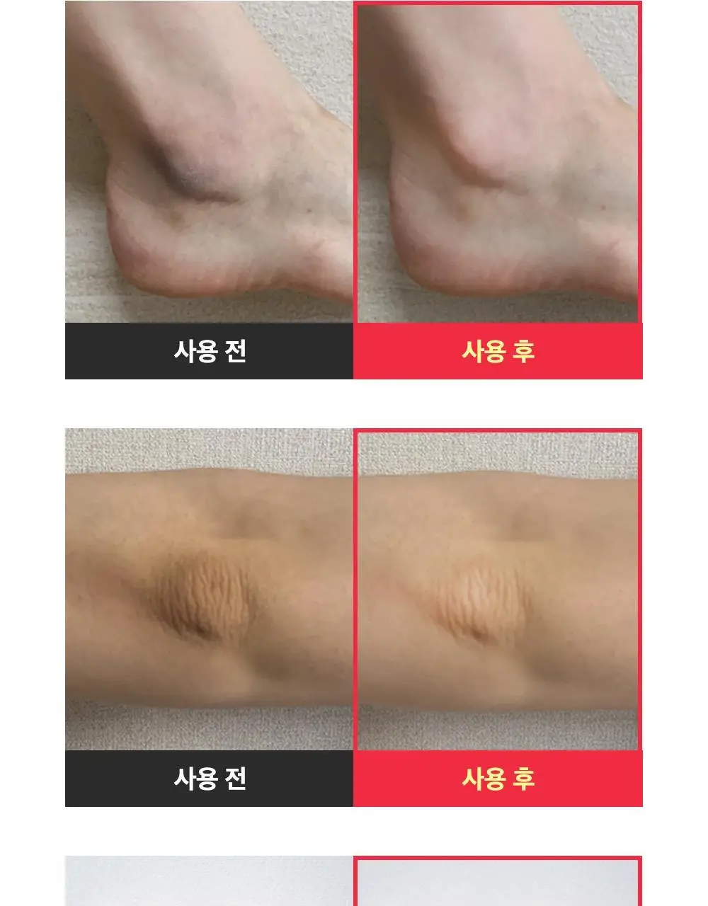 [데일리풋케어/맨들맨들아기발] 성분에디터 시어버터 베이비 풋 스틱 20g 2종 택 1 상세페이지 32